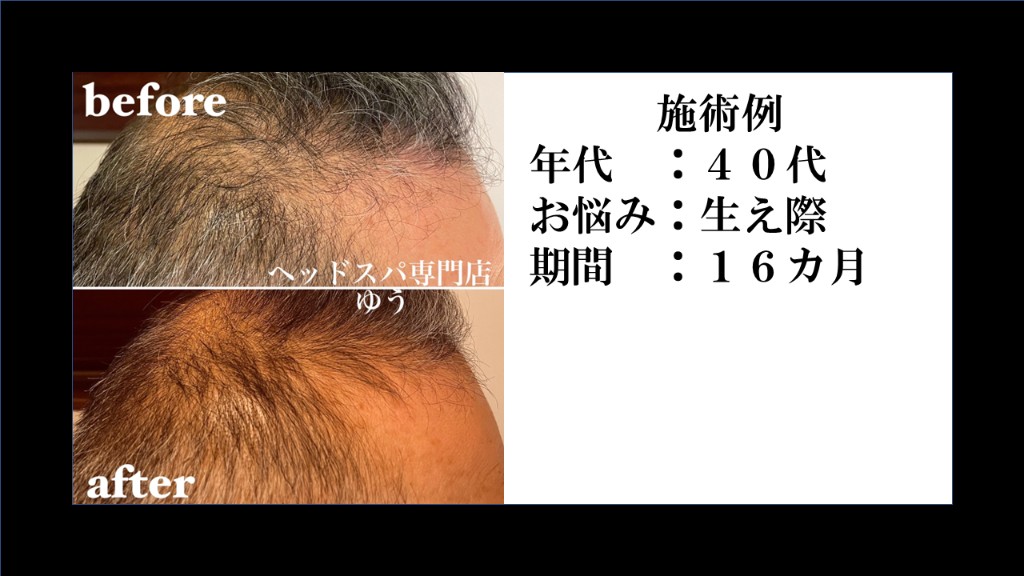 Before & After 7