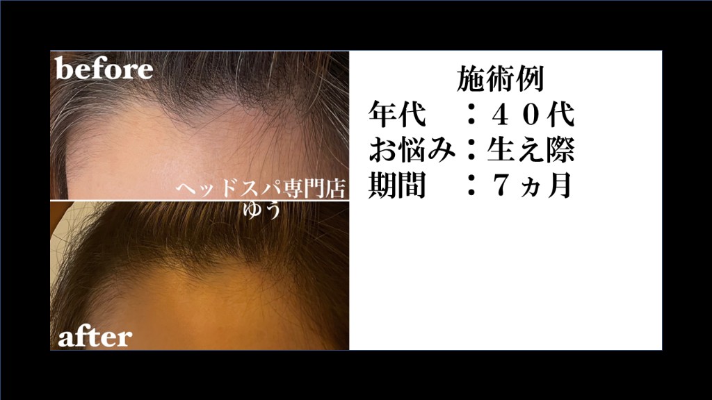 Before & After 9