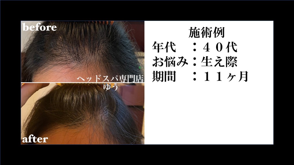 Before & After 10